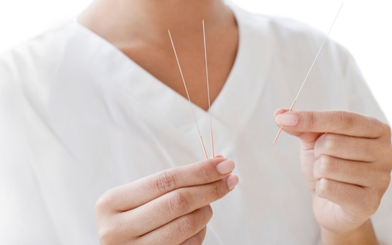 woman holding acupuncture needles